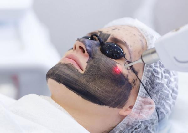 Carbon Peel Laser ช่วยเรื่องอะไร